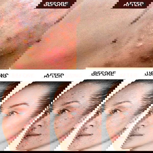 غسول  Image 6 Preview