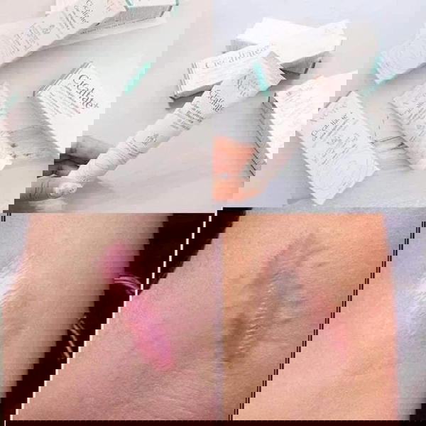 كريم ترميم Image 2 Preview
