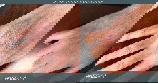 كريم ترميم Image 7 Preview