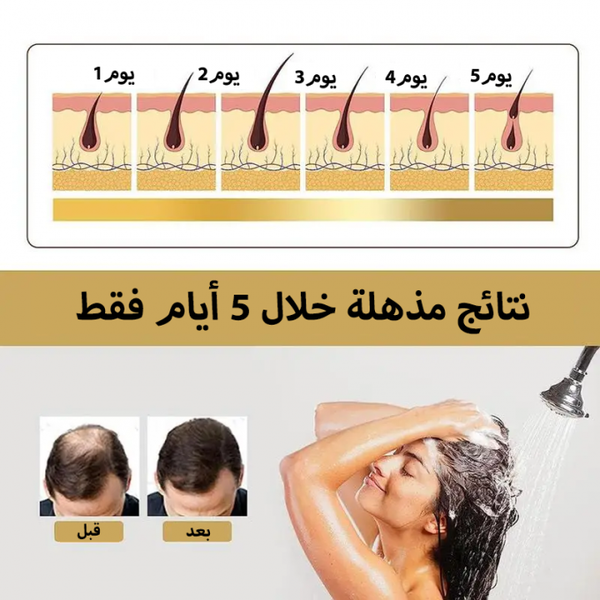 شامبو ساكورا ياباني Image 3 Preview