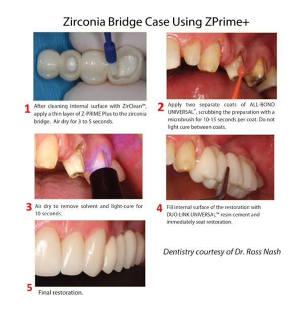 Bisco Z -Prime plus (0.5ml) Image 4 Preview