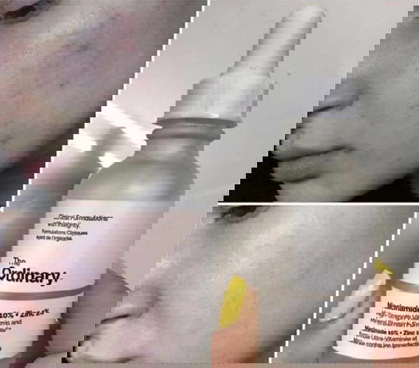 اورديناري نياسيناميد Image 3 Preview