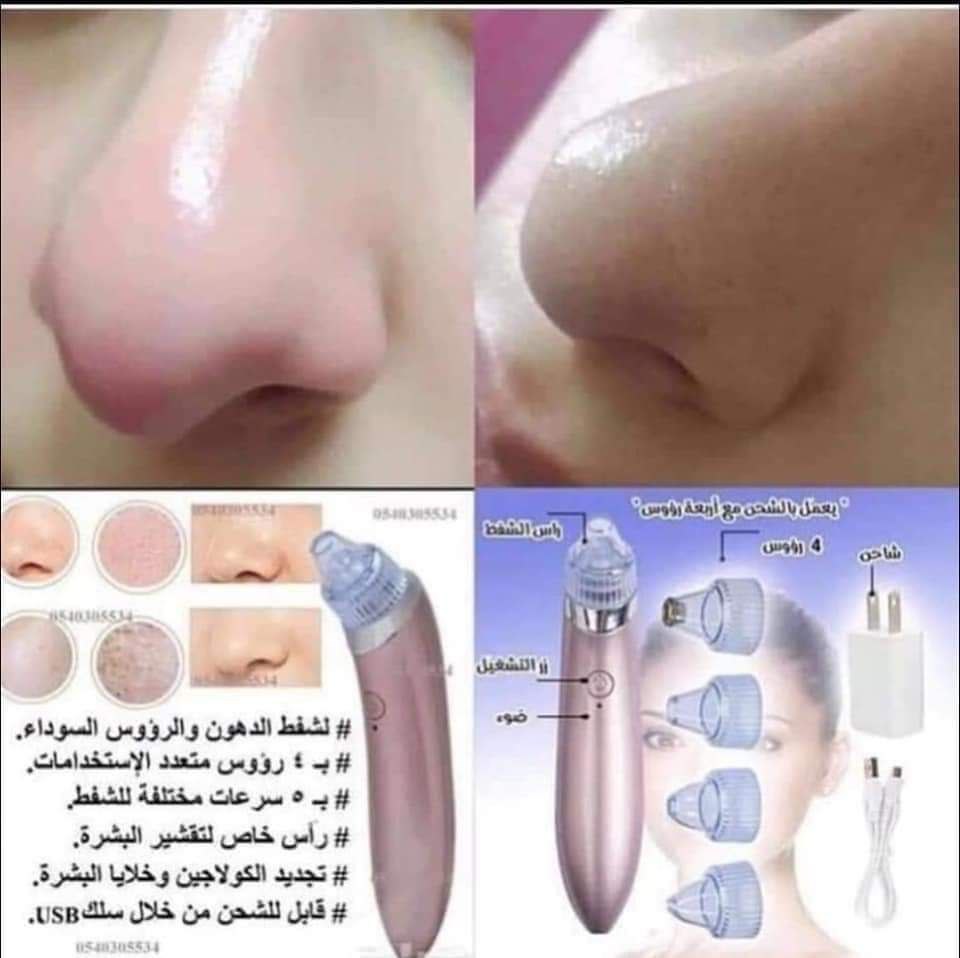 جهاز شفط الدهون Preview Image