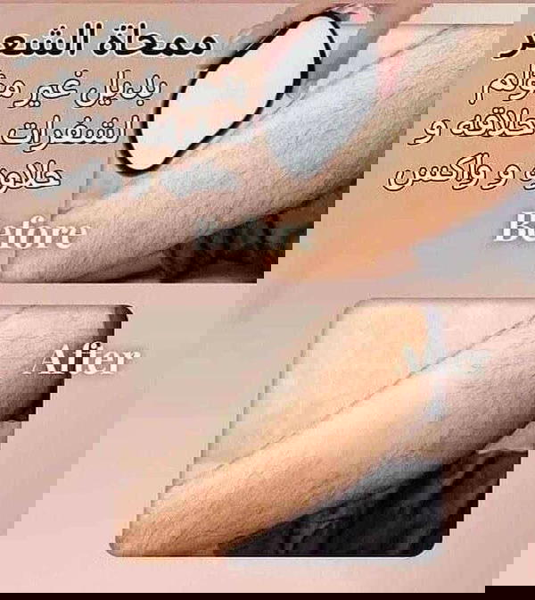 كريستالة ازالة الشعر الاصلية Image 2 Preview
