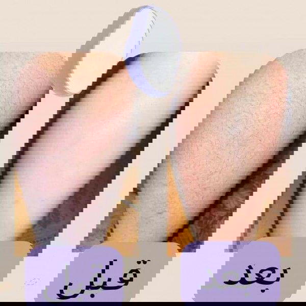 كريستالة ازالة الشعر الاصلية Image 3 Preview