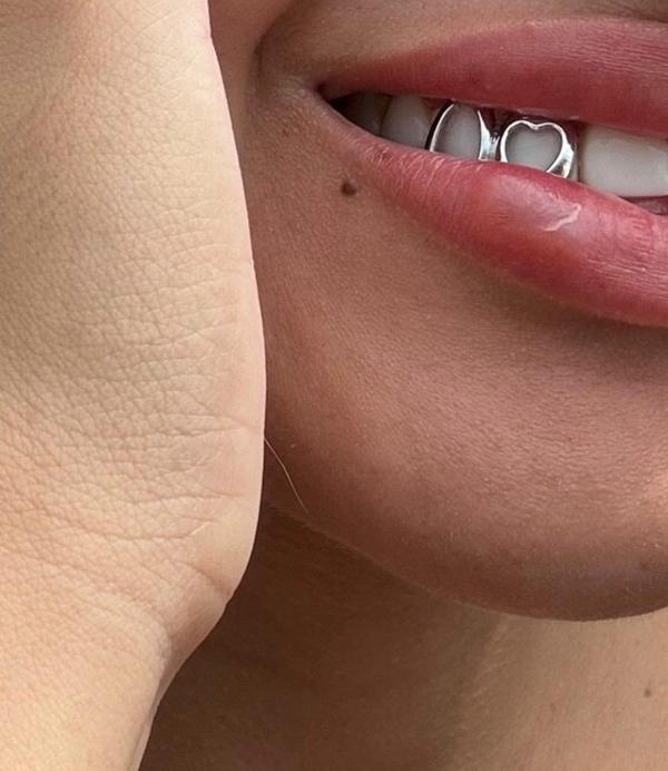 Fake tooth gems Image 2 Preview