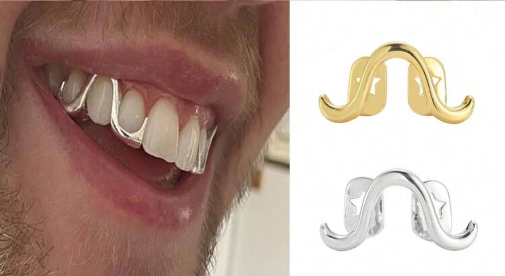 gold tooth gems Preview Image