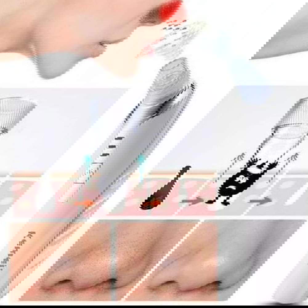 KM-1868 جهاز الكتروني لشفط الرؤوس السوداء ومنظف مسام الوجه Preview Image