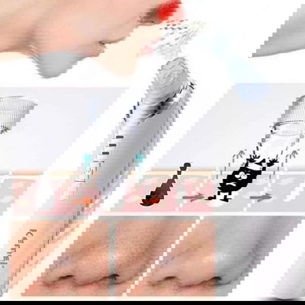 KM-1868 جهاز الكتروني لشفط الرؤوس السوداء ومنظف مسام الوجه Image 5 Preview