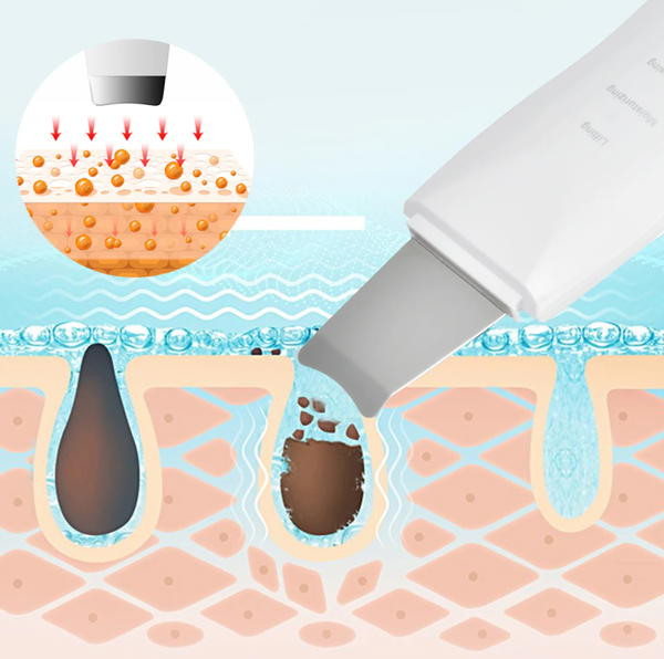 جهاز التراسونيك سكن سكرابر Ultrasonic Skin Scrubber  Image 6 Preview