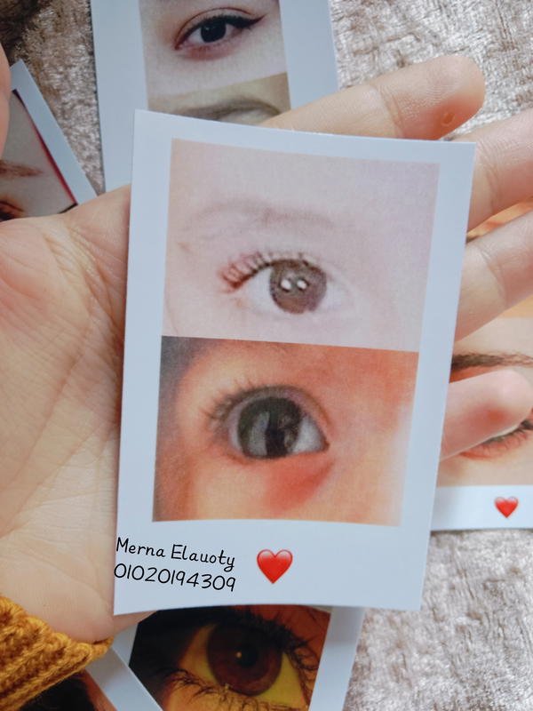 كارت العيون 🎀 Image 4 Preview