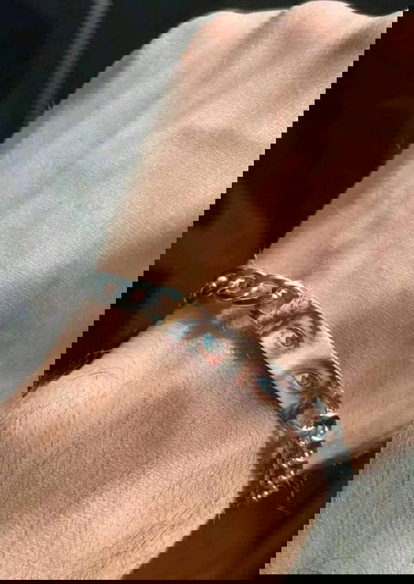 Ansial Eye Image 2 Preview
