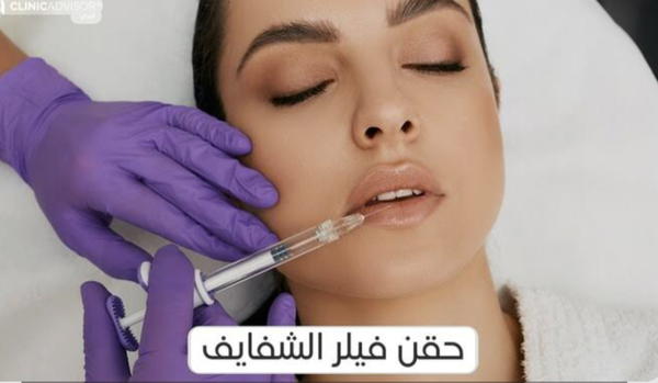 فيلر Image 1 Preview