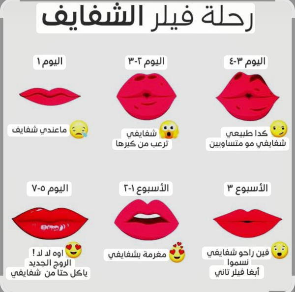 فيلر Image 2 Preview