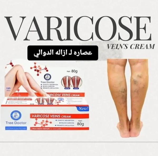 علاج دوالي القدم  Image 1 Preview
