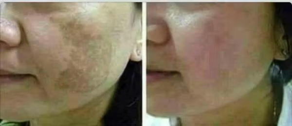 عصارة موفيت Image 2 Preview