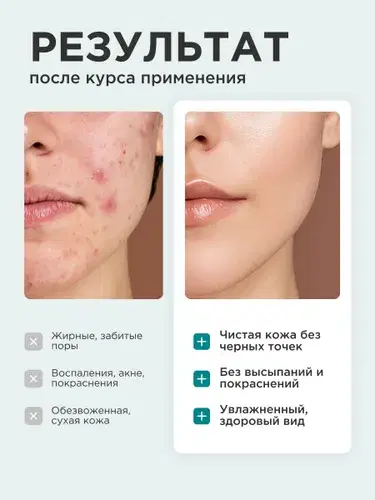 غسول BHA Image 9 Preview