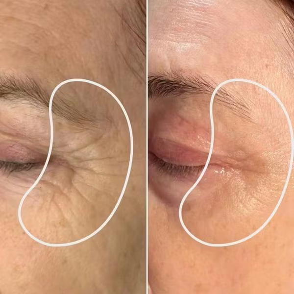 خيوط الكولاجين Image 3 Preview