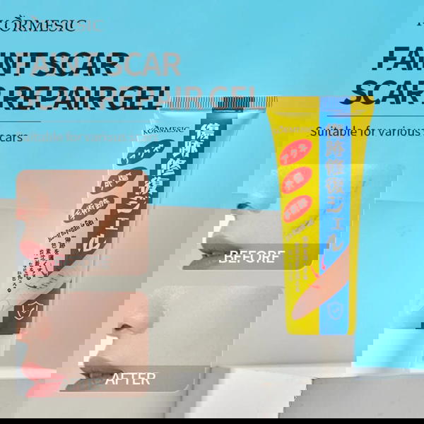 كريم علاج الوجه والندبات Image 1 Preview