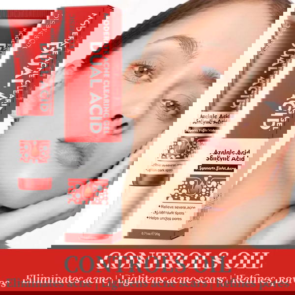 كريم علاج حب الشباب  Image 1 Preview