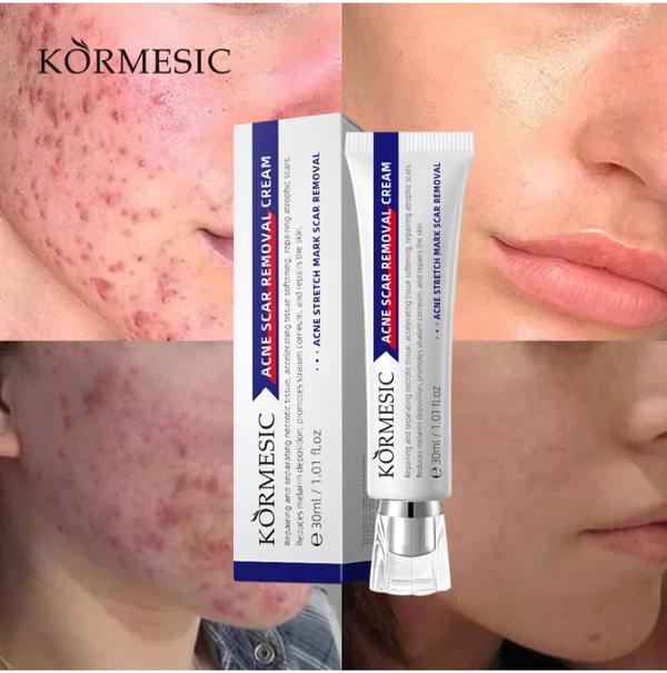 كريم معالج للندبات والاثار  Image 2 Preview