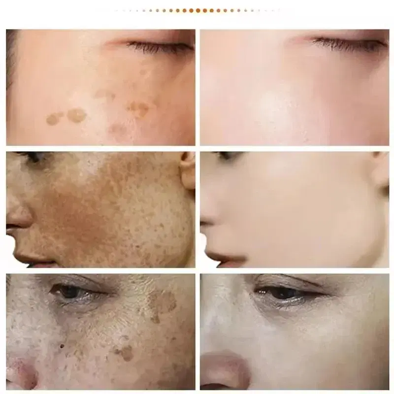 كريم Anti-Freckle Preview Image