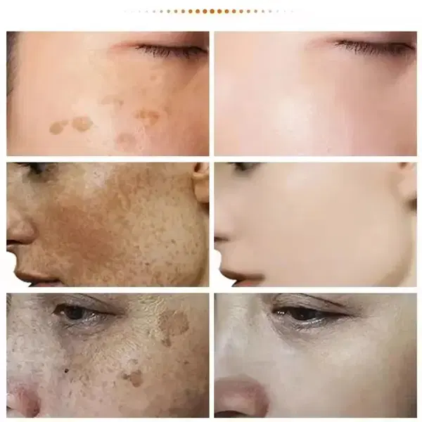 كريم Anti-Freckle Image 1 Preview