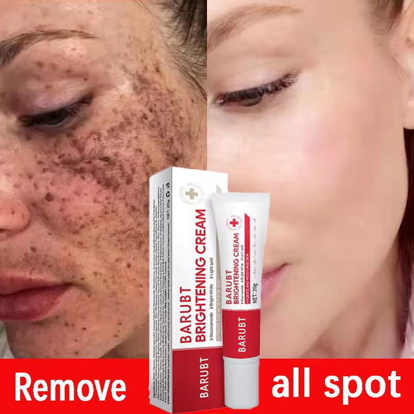 كريم Anti-Freckle Image 2 Preview