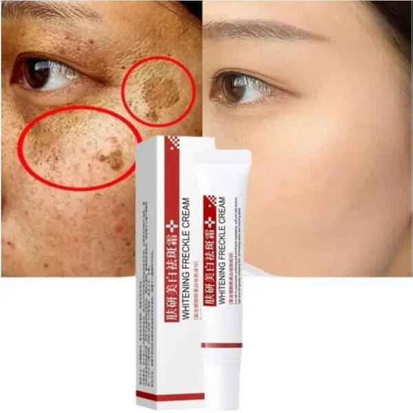 كريم Anti-Freckle Image 4 Preview