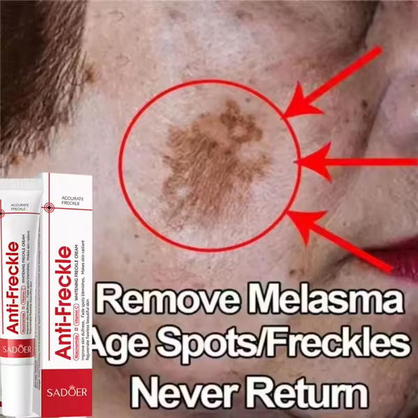 كريم Anti-Freckle Image 6 Preview
