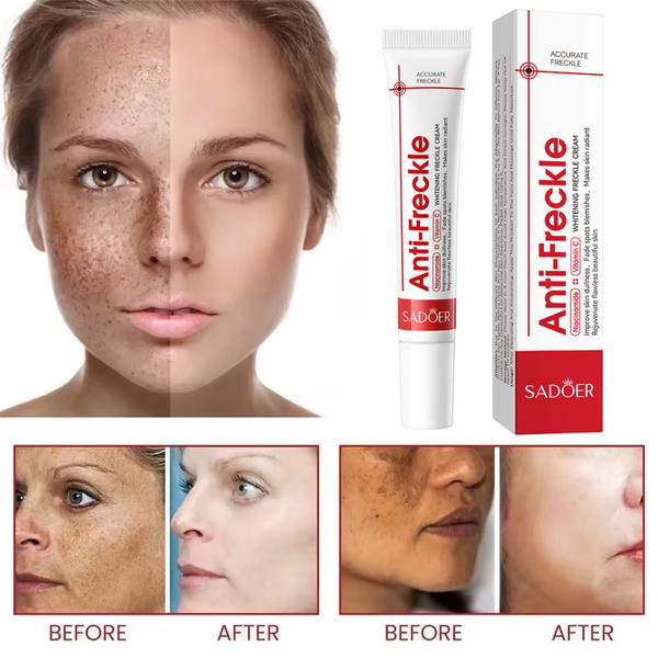 كريم Anti-Freckle Image 7 Preview