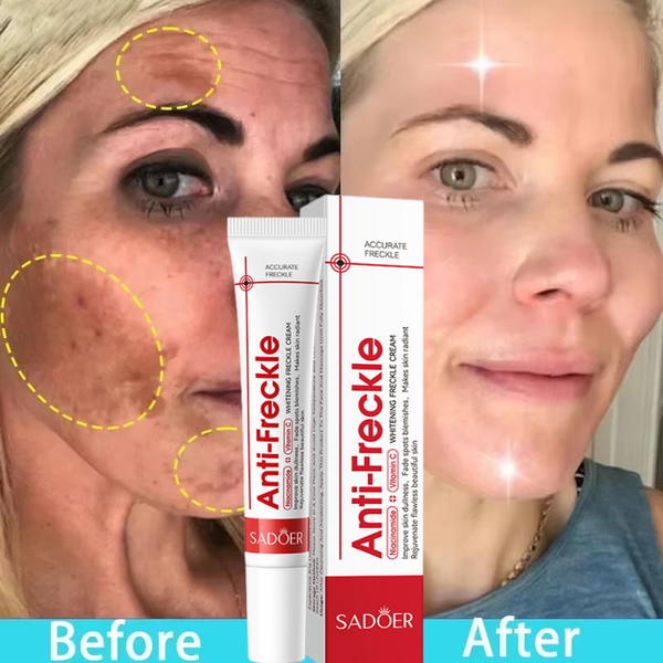كريم Anti-Freckle Image 9 Preview