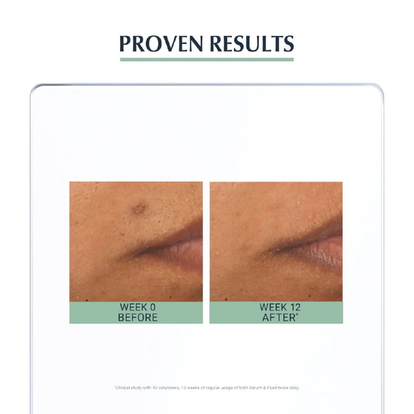 سيروم يوسرين ثلاثي المفعول  Image 6 Preview