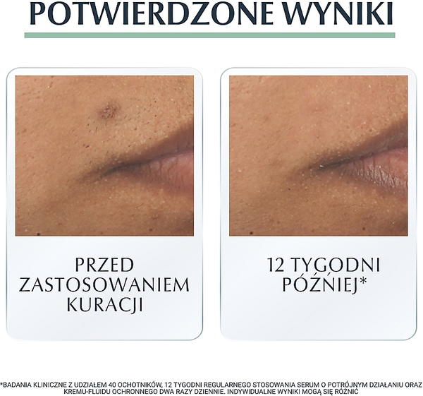 سيروم يوسرين ثلاثي المفعول  Image 10 Preview