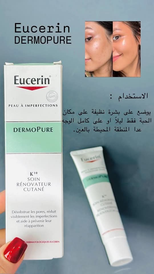 يوسيرين لمعالجة المسامات  Image 6 Preview