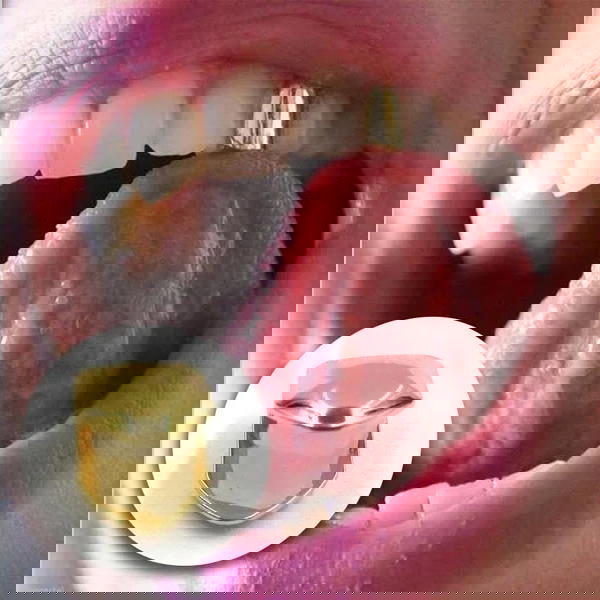 Teeth Grillz - إكسسوار أسنان Image 1 Preview
