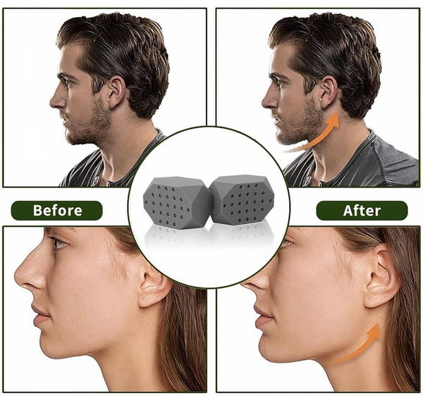 أداة تنحيف الفك (تكساس) Image 6 Preview