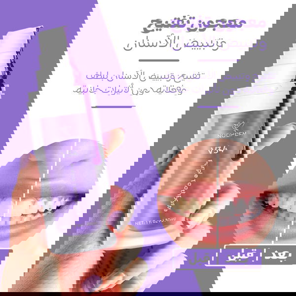 عرض حبتين جيل تبييض وتنظيف الاسنان السحري Image 1 Preview