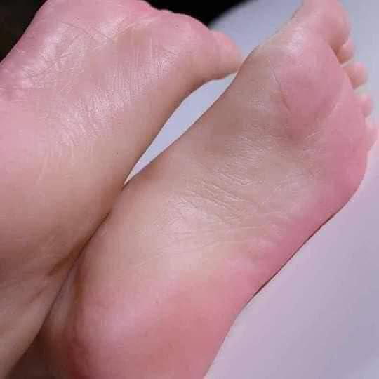 شراب سيليكون طبي   Image 6 Preview