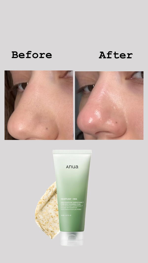 غسول الوجه من anua Image 2 Preview