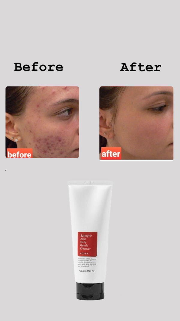 غسول وجه من cosrx Image 2 Preview