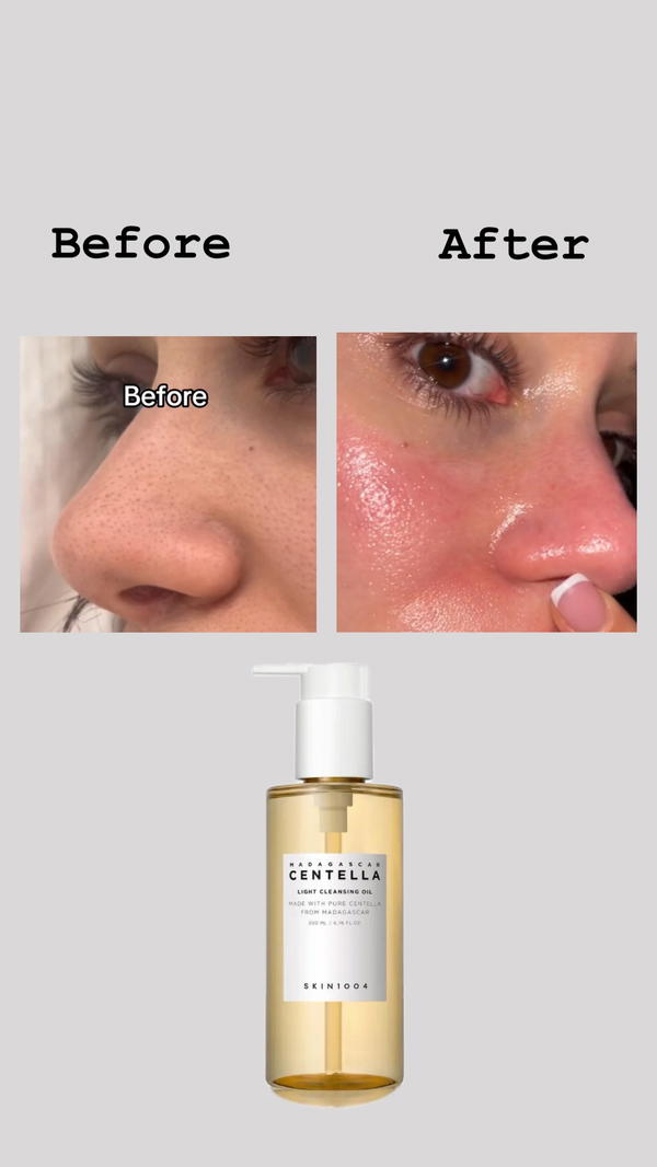 غسول زيتي من  skin1004 Image 2 Preview