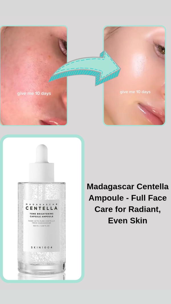 سيروم التفتيح (100 مل) من skin1004 Image 2 Preview