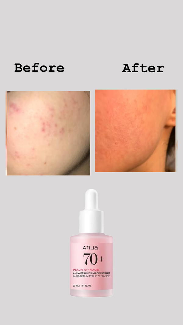 سيروم نضارة للبشرة من anua Image 2 Preview