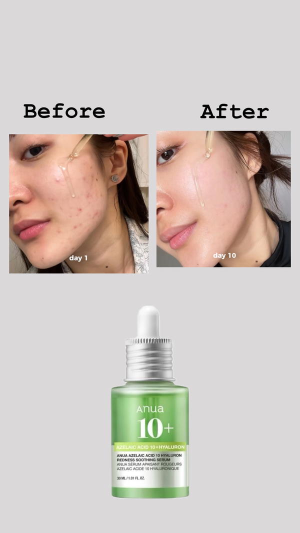 سيروم تهدئة البشرة من anua Image 2 Preview